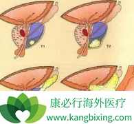 Ϊʲô�����ع��߻���Ҫֹͣʹ�ð�������(XBIRA)