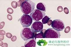 ��Ѫ����ô�Σ���Ѫ������Щ���Ʒ�����