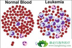 �����жϰ�Ѫ�������費��Ҫ���й�����ֲ