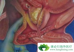 ������ʳ�������˶���Ԥ��ǰ���ٰ�֢����Ч�ֶ�