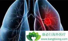 �ΰ���ת�Ʒ����������������Ʋ����ӳ�������