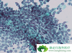 ��Ī¬����(Cyramza)������·��Ƥ����III��������