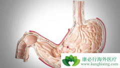 θ��D2��������ʹ�ð�ɳ����(Eloxatin)����������Ч����