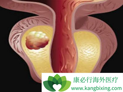 阿比特龙 阿比特龙