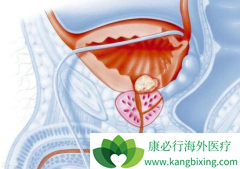 ��������(XBIRA)�ɸ���δ�����Ƶ�CRPC���ߵ�X���������޽�չ������