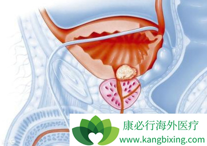 阿比特龙 阿比特龙