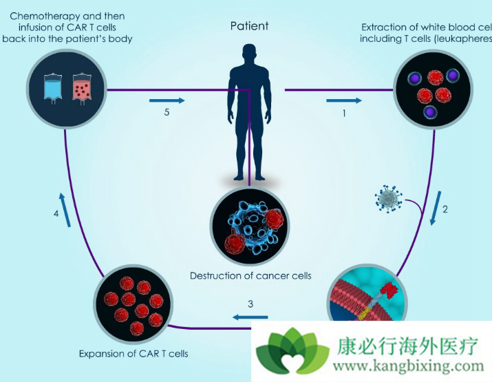 CAR-T细胞治疗 CAR-T细胞治疗