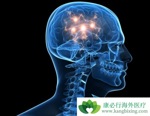 癌症脑转移 癌症脑转移