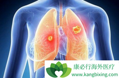 ��������(GILOTRIF)������޿������˸��õ��޽�չ������