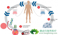 ϸ�����������Ʒ�CAR-Tϸ���Ʒ��е�CAR��ʲô��˼