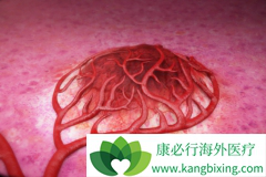 ���ڸΰ����߳Կ��ΰ�ҩ������(REGORAFENIB)�ܻ���