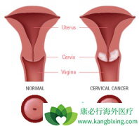 ��������(Bevacizumab)���ϻ��ƿ���߹�������λ����3.7����