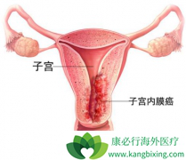 ����˹͡(Avastin)��ҩ���ӹ���ϸ��������������Ϊ61%