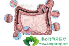 �����鵥��(Bevacizumab)�ܷ�����ת���Խ�ֱ��������