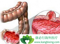 ���ᵥ��(Vectibix)�ﵽ�˸���ת���Խ�ֱ���������������ڵ�Ŀ��