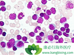 ��³����(IBRUTINIB)������G-CSFRͻ���������Ѫ������Ч����