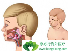 �ϼ�����³����(IBRUTINIB)�Զ��ֲ�ͬ���ܰ������в�������Ч