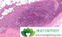 ��������(IBRANCE)�ǵ�һ�����Ƴ����ٰ������ڷ���������ҩ��ҩ��