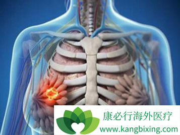 帕唑帕尼 帕唑帕尼