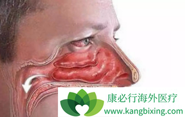ʰ
