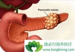 ���ѡ�����ٰ������Ʒ������ܷ�ȡ����Ч�Ĺؼ�