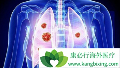 �ΰ����ڿ����κ��𣿷ΰ����ڵ����Ʒ�����ôѡ��