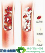 AHI-1�����ǵ��°�Ѫ�����߶�ӡ�ȸ�������Ӧ�����Ҫԭ��