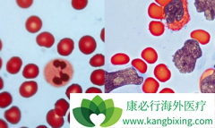 �������ʸ�����/�������ὺ�ҵĻ��߿ɽ�ҩ���ɢ��ƻ��֭��