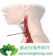 ��״�����������𣿲����ƻ��ݱ�ɼ�״�ٰ���