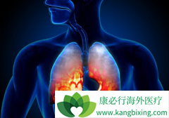 ���Ʒΰ��۰��İ���ҩ����Щ��PD-1�����Ʒ����κ÷��۰���