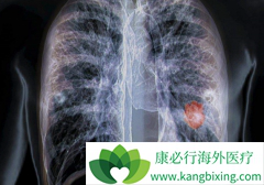 ̵�д�Ѫ��ʲô���£�̵�д�Ѫ�Ƿΰ�����֢״��