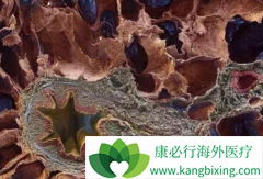 �ط��Է���ά����ô���ƣ�������ͪ���Ʒ���ά��Ч������