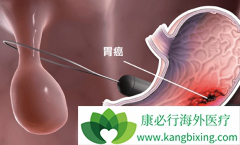 ��������Ƭ(Capecitabine)��������θ��������ٴ���Ч