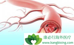 ���Ǹ����Ԥ�����ǶȰ����������Ѫ˨����?