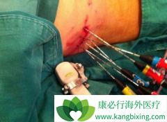 �ճ��������Ԥ���ΰ����ΰ����Ʒ�������Щ��