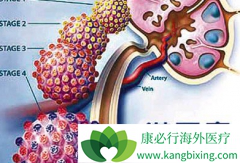 ���ÿ�������(CRIZOTINIB)��ȫ�����ͣҩ�ָ�������ô����