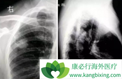 �ΰ����߷���ӡ������ɳ(GEFINAT)��Ч����Ҫ�Զ�ã�