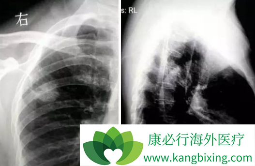 印度易瑞沙 印度易瑞沙