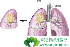 �׹��ټ��غͼ�������(GEFINAT)���Ӧ���е���ͨ·������