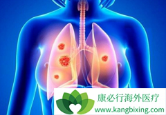 �ΰ�����һ�߷��ö�������(GRLONAT)����ֽ�չ����ô��