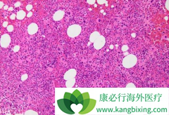 ��������/��ϣ�ɽ���������Գ���CML�����и��ߵ�MMR��