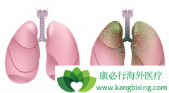 ̩����/�����鵥������Ҫ�������ڶ�Ƥ���Ĳ�����ӦС