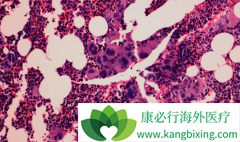 ʲô�ǹ�����ά����«���������ƹ�����ά����ʲô���ƣ�