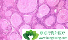 ����������/���޻����ϱ����ᵪ��ɸ���MALT�ܰ���Ԥ��