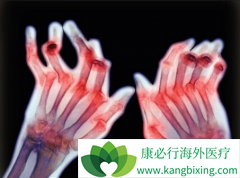 ���޻�/����������¡���岻������ʹ�ڷ�ʪ�ؽ��׻��ߵĸ�Ⱦ�¼�