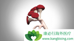 ���޻�(Ristova)���ư������ܲ�ȫ�͵�����ĸ�ΣIgAN���ߵ���Ч