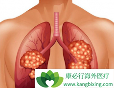 �ΰ�ҩ�ﰢ������(GILOTRIF)�����ڷ��۰���������