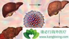 ��άĪ˾(Afinitor)���ܸ������ڸΰ����ߵ��޽�չ������