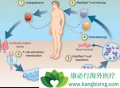 ��ϵͳ������Ӧ�ǳ�����CAR-T���Ƹ�����֮һ