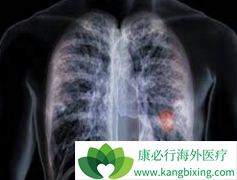 �����ΰ�ҩ�￭����/�������������ڷΰ����ߵ���ѡ��